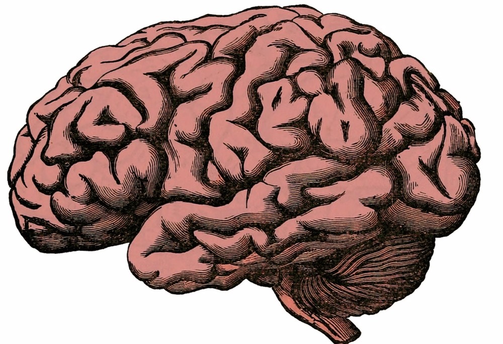 hemorragia intracraneal